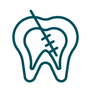 cabinet-dentaire-obiou-specialite-endodontie