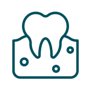 cabinet-dentaire-obiou-specialite-parodontologie